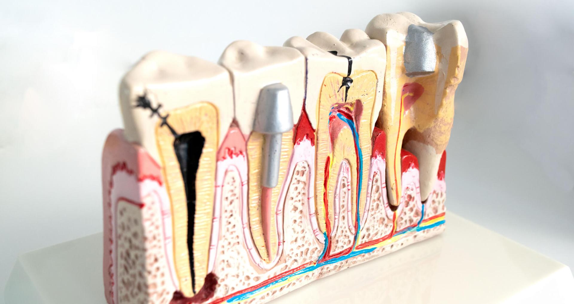 Sample dentes